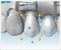 fUC\tgEFA-Dental WingsЁ@fUCi[